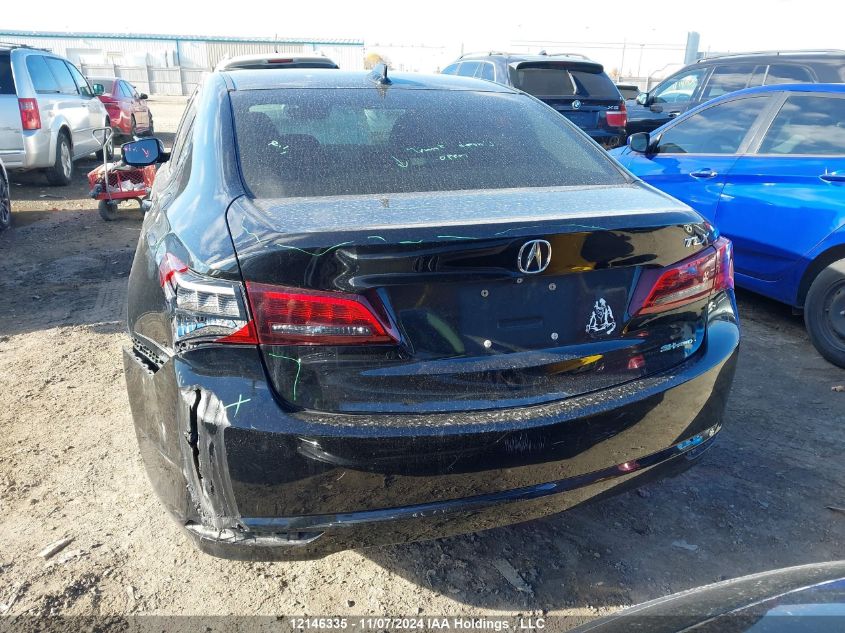 2015 Acura Tlx VIN: 19UUB3F56FA800998 Lot: 12146335