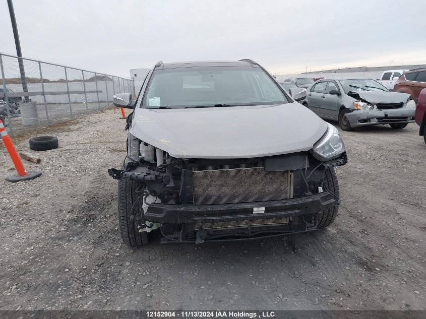 2017 Hyundai Santa Fe Sport 2.4 Se VIN: 5XYZUDLB8HG472162 Lot: 12152904