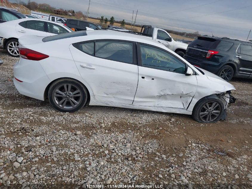 2017 Hyundai Elantra Se/Value/Limited VIN: KMHD84LF5HU138327 Lot: 12153887