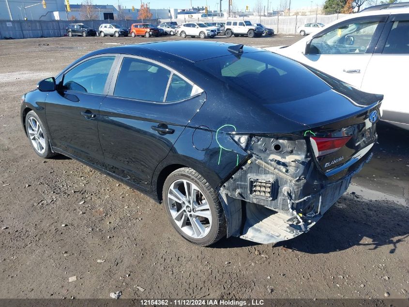 2017 Hyundai Elantra Gls VIN: KMHD84LF7HU187304 Lot: 12154362