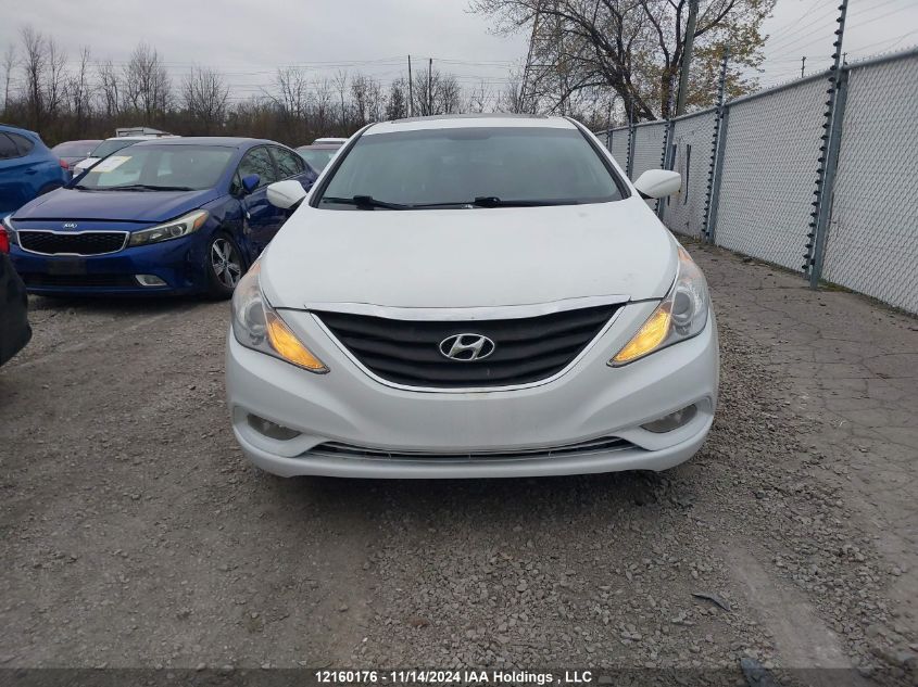 2013 Hyundai Sonata Gls VIN: 5NPEB4AC5DH593301 Lot: 12160176