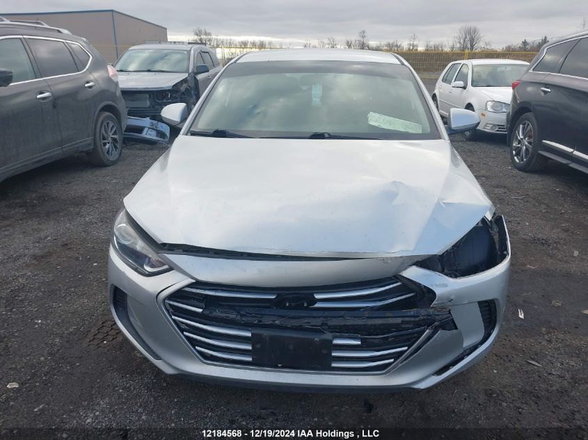 2017 Hyundai Elantra Le VIN: 5NPD74LFXHH148966 Lot: 12184568