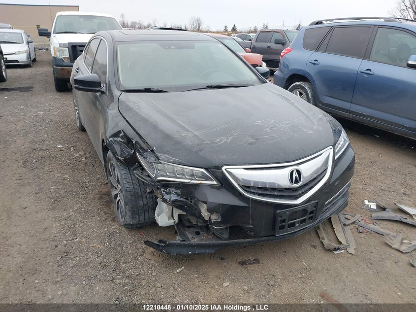 19UUB1F54HA800392 2017 Acura Tlx Tech auction photo 1
