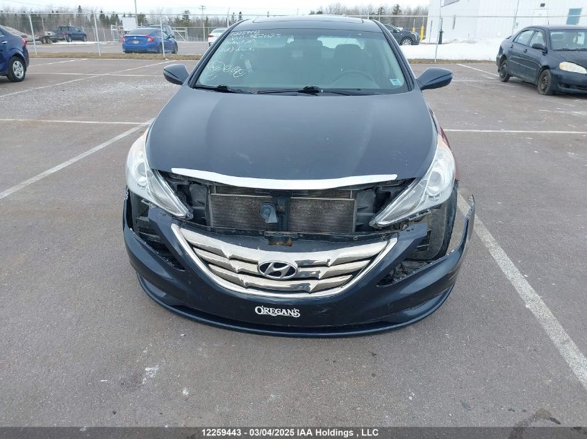 2013 Hyundai Sonata Gls VIN: 5NPEB4AC2DH562023 Lot: 12259443