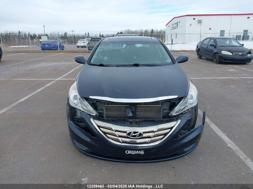 2013 Hyundai Sonata Gls VIN: 5NPEB4AC2DH562023 Lot: 12259443