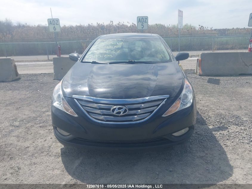 2013 Hyundai Sonata Gls VIN: 5NPEB4AC4DH530237 Lot: 12307618X
