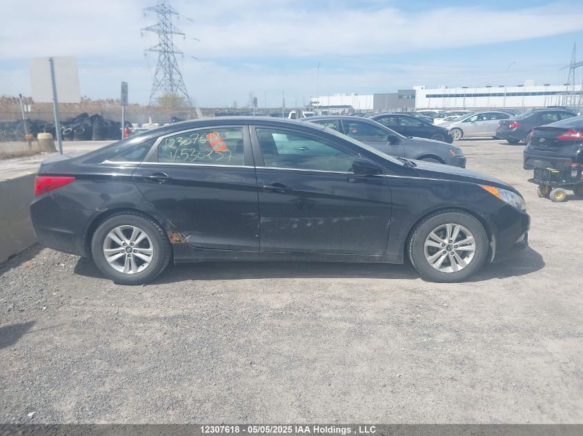 2013 Hyundai Sonata Gls VIN: 5NPEB4AC4DH530237 Lot: 12307618X