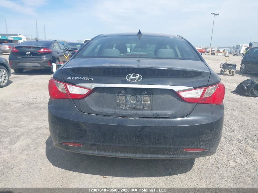 2013 Hyundai Sonata Gls VIN: 5NPEB4AC4DH530237 Lot: 12307618X