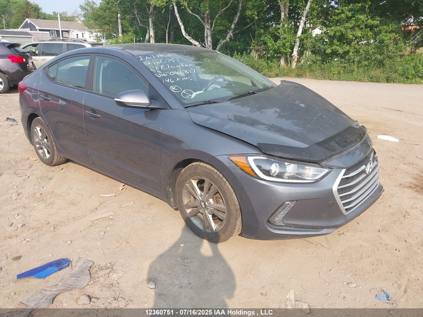 KMHD84LF5HU091817 2017 Hyundai Elantra Se/Value/Limited auction photo 1