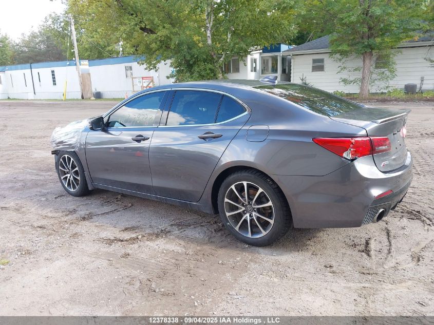 2019 Acura Tlx VIN: 19UUB3F3XKA802410 Lot: 12378338