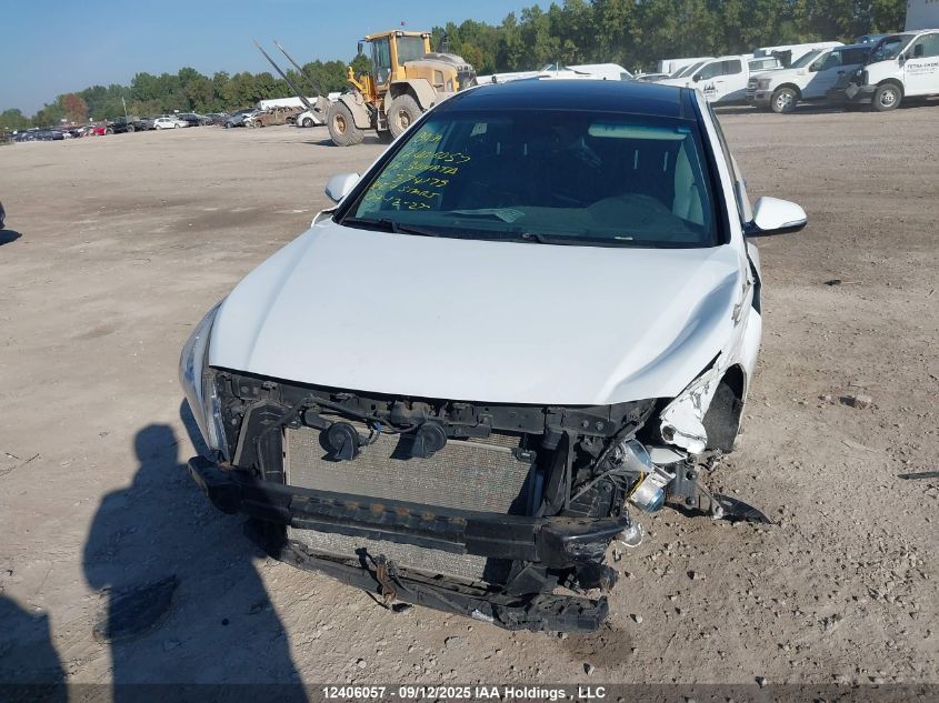 2016 Hyundai Sonata Sport/Limited VIN: 5NPE34AF0GH374175 Lot: 12406057