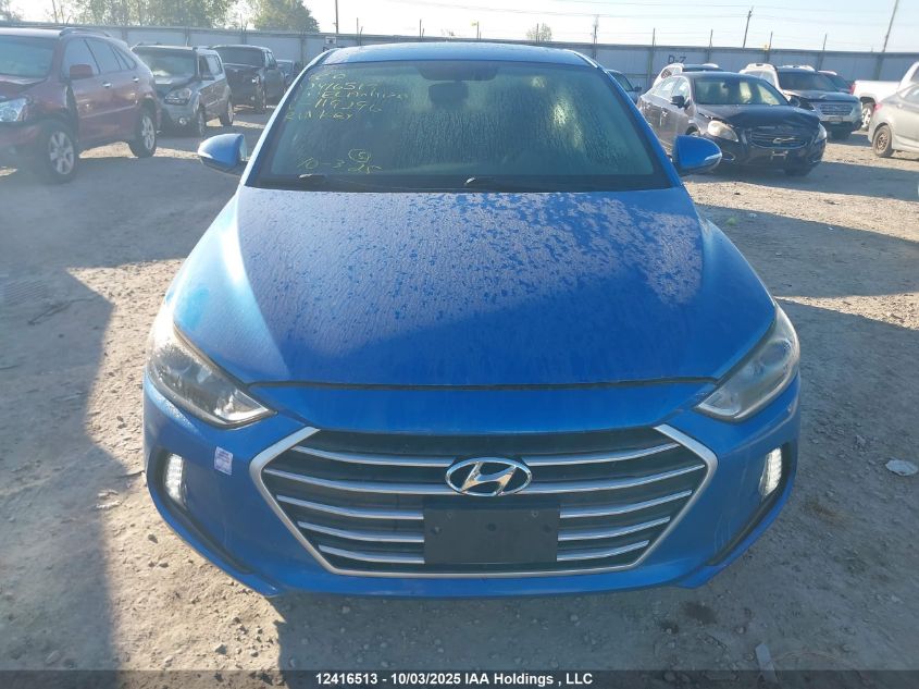 2017 Hyundai Elantra Gls VIN: KMHD84LF2HU119296 Lot: 12416513