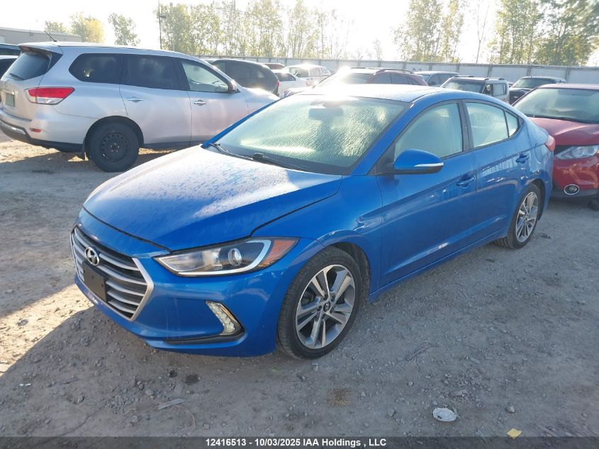2017 Hyundai Elantra Gls VIN: KMHD84LF2HU119296 Lot: 12416513