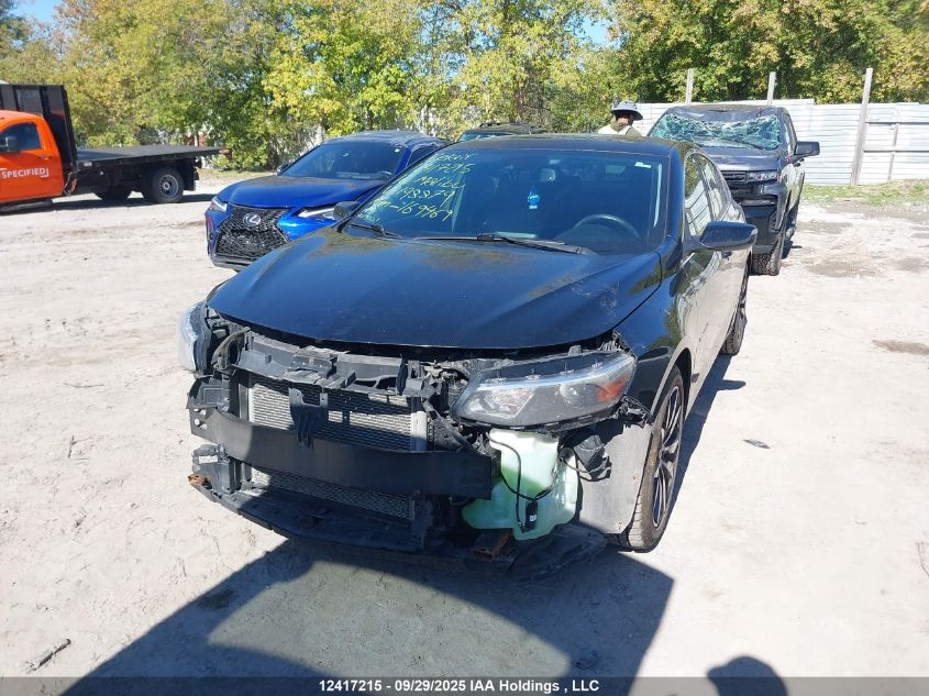 2016 Chevrolet Malibu VIN: 1G1ZE5ST9GF198879 Lot: 12417215