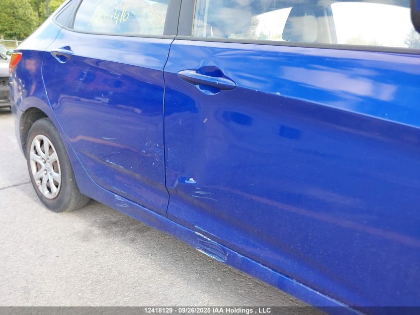 2012 Hyundai Accent VIN: KMHCT4AE3CU170416 Lot: 12418129