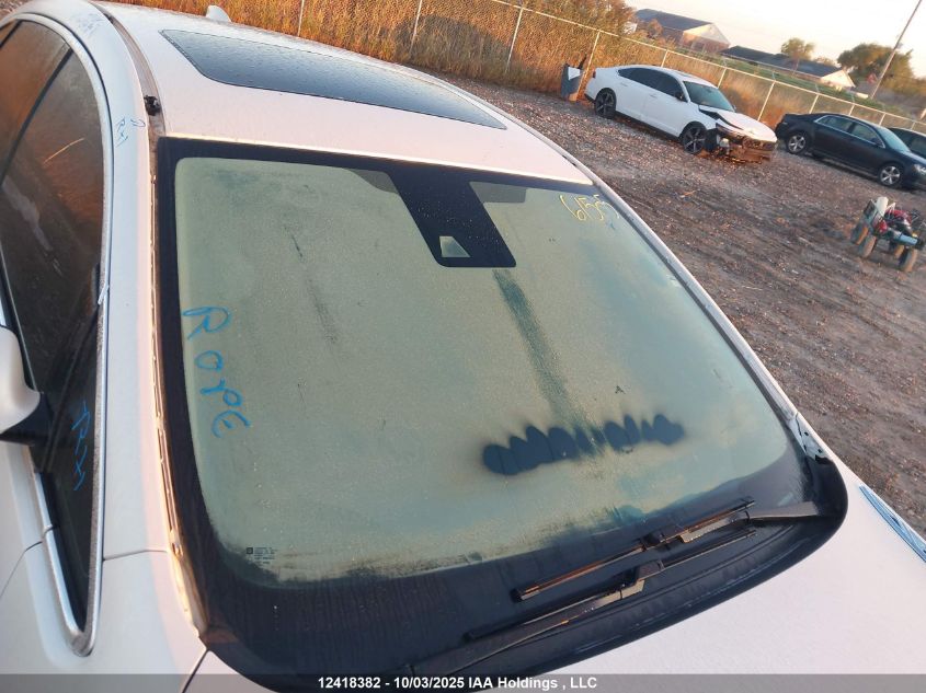 2015 Buick Verano VIN: 1G4PS5SK1F4165153 Lot: 12418382