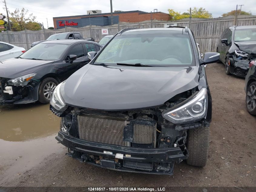 2017 Hyundai Santa Fe Sport 2.0T Ultimate VIN: 5XYZUDLA4HG475356 Lot: 12418517