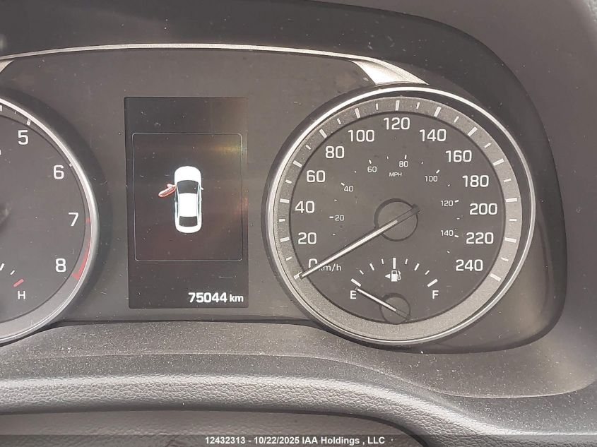 2017 Hyundai Elantra Limited VIN: KMHD84LF8HU255450 Lot: 12432313