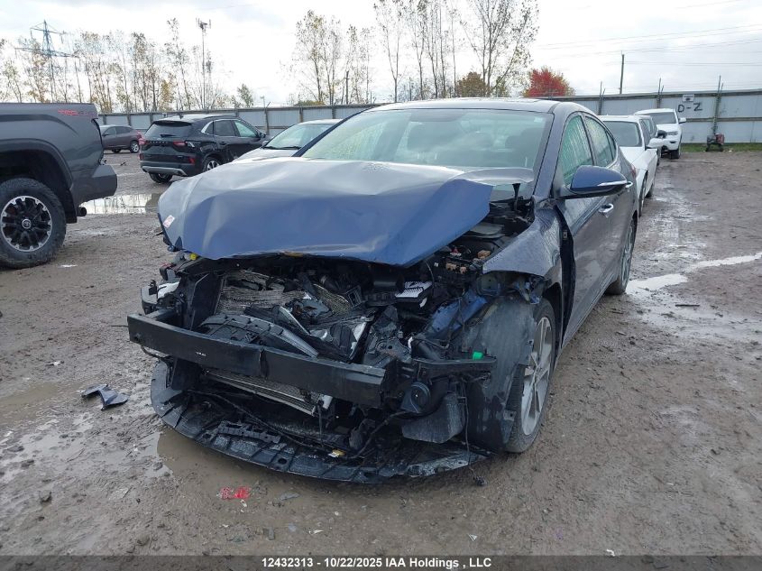 2017 Hyundai Elantra Limited VIN: KMHD84LF8HU255450 Lot: 12432313