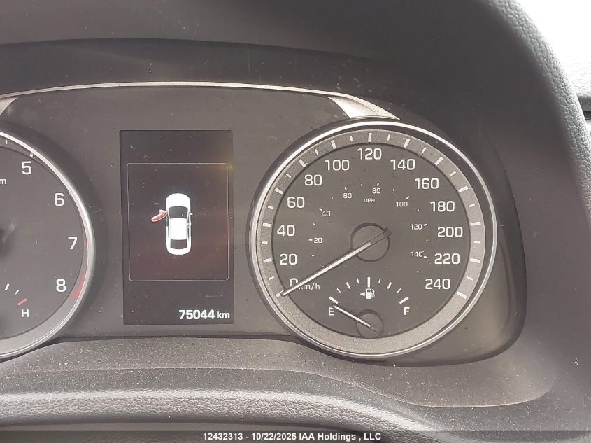 2017 Hyundai Elantra Limited VIN: KMHD84LF8HU255450 Lot: 12432313