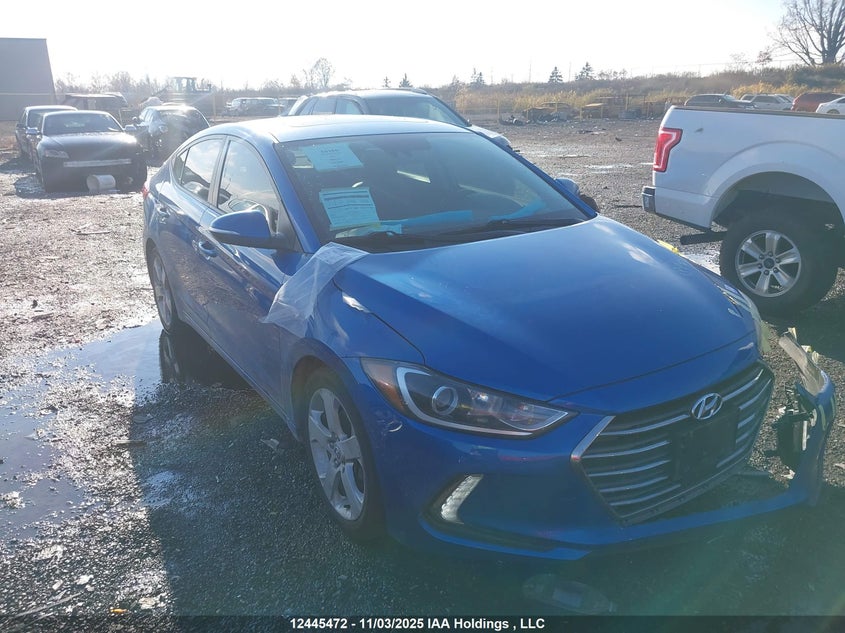 KMHD84LF1JU663830 2018 Hyundai Elantra Gls auction photo 1