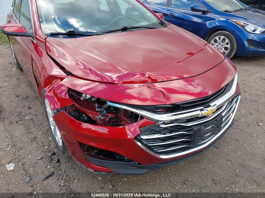1G1ZD5ST8PF239263 2023 CHEVROLET MALIBU photo no. 6