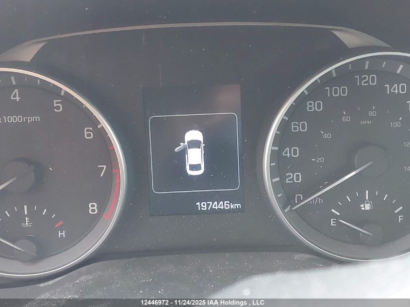 2017 Hyundai Elantra Gl VIN: KMHD84LF8HU132456 Lot: 12446972