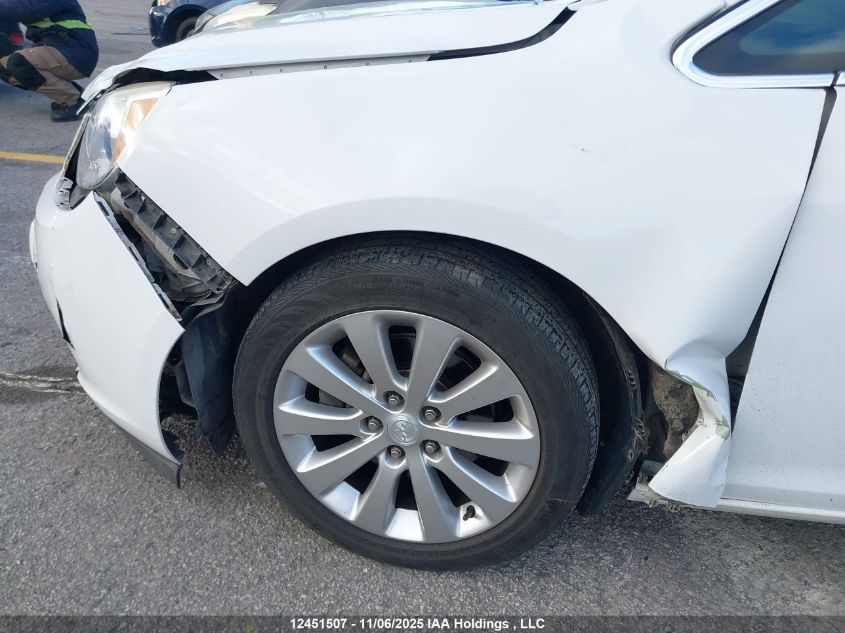 2017 Buick Verano VIN: 1G4PP5SK9H4102208 Lot: 12451507