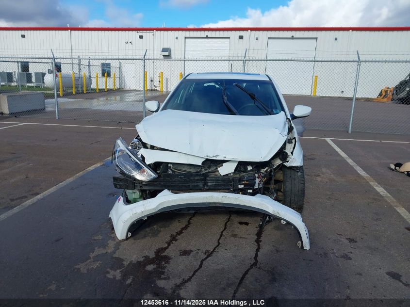 2017 Hyundai Accent Se VIN: KMHCT5AE8HU309193 Lot: 12453616