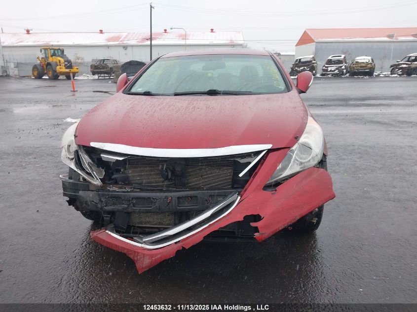 2014 Hyundai Sonata Gls VIN: 5NPEB4ACXEH924522 Lot: 12453632