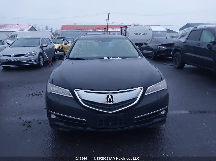 2016 Acura Tlx Advance VIN: 19UUB3F71GA802077 Lot: 12455641
