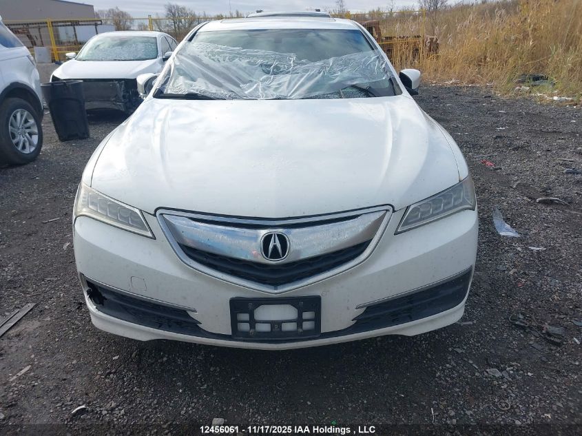 2015 Acura Tlx VIN: 19UUB3F37FA802161 Lot: 12456061