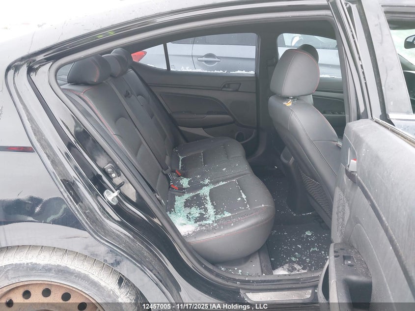 2017 Hyundai Elantra Sport VIN: KMHD04LB9HU292091 Lot: 12457005