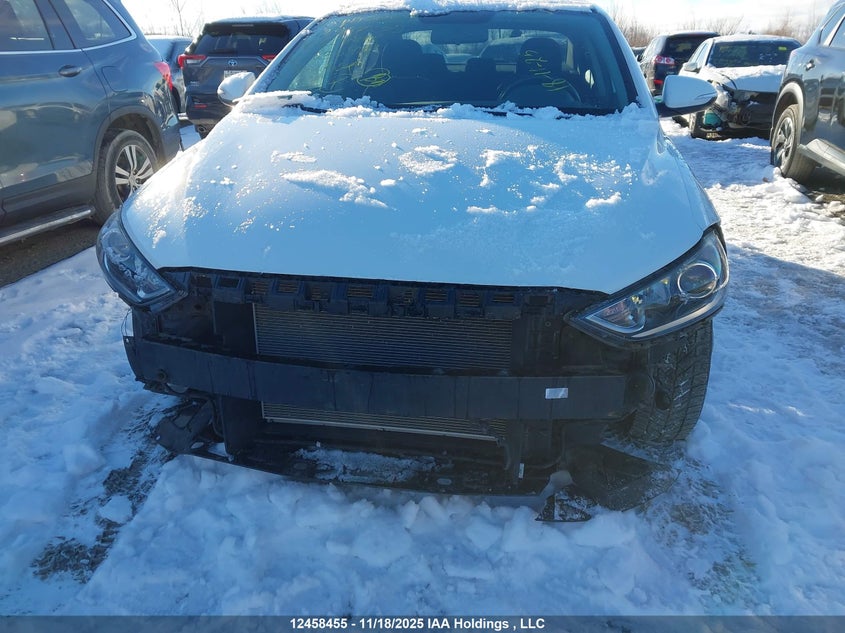 KMHD84LF3JU635432 2018 HYUNDAI ELANTRA photo no. 6