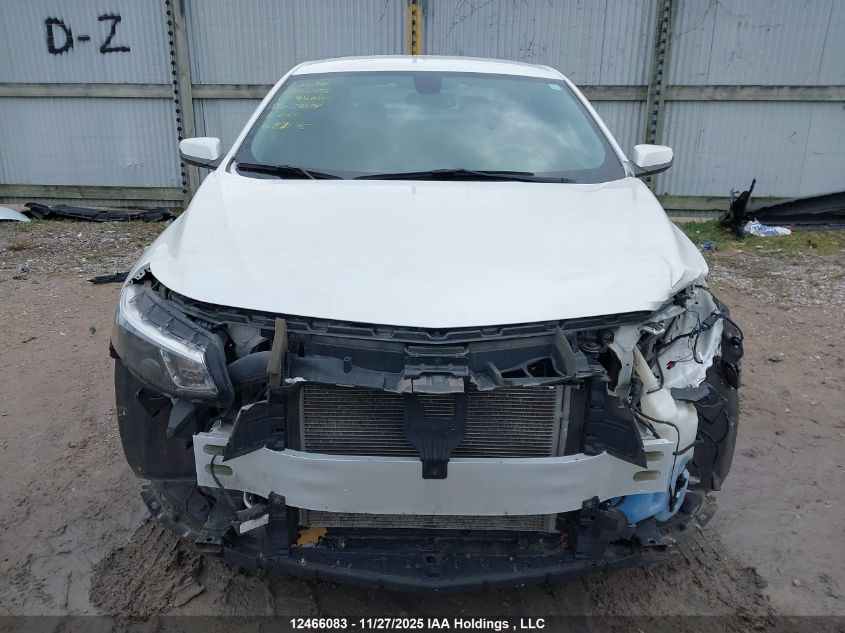 2017 Chevrolet Malibu VIN: 1G1ZE5STXHF241174 Lot: 12466083