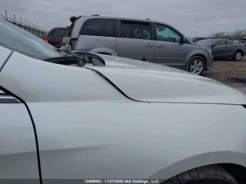 2017 Chevrolet Malibu VIN: 1G1ZE5STXHF241174 Lot: 12466083