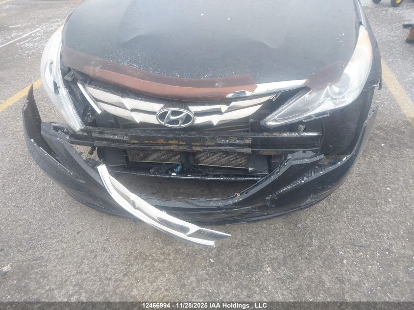 2013 Hyundai Sonata Gls VIN: 5NPEB4AC4DH568535 Lot: 12466994