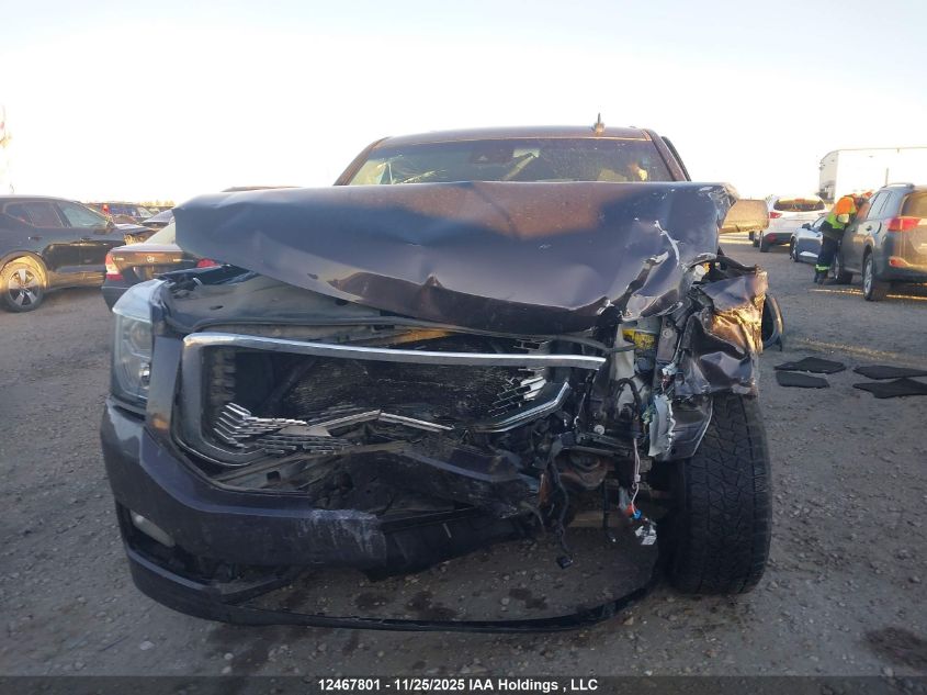 2015 GMC Yukon Denali Denali VIN: 1GKS2CKJ9FR662825 Lot: 12467801