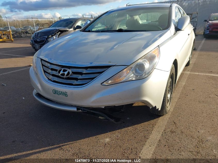 2013 Hyundai Sonata Gl VIN: 5NPEB4AC2DH731392 Lot: 12470973
