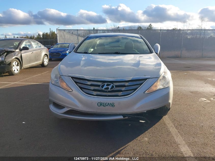 2013 Hyundai Sonata Gl VIN: 5NPEB4AC2DH731392 Lot: 12470973