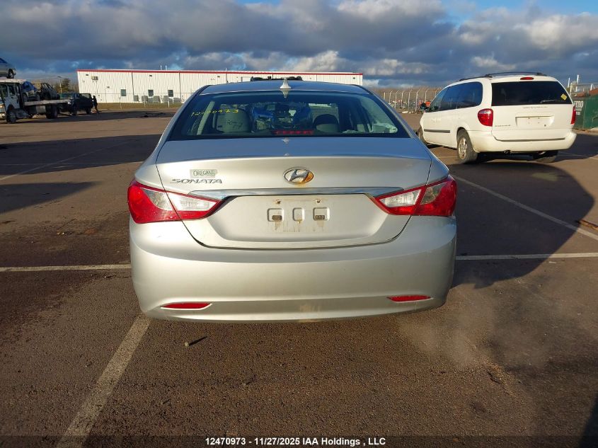 2013 Hyundai Sonata Gl VIN: 5NPEB4AC2DH731392 Lot: 12470973