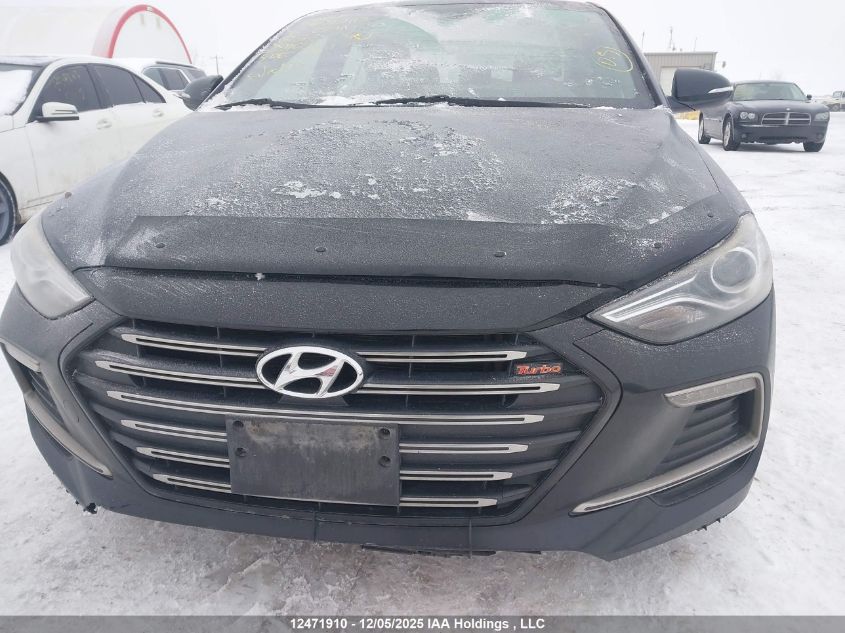 2017 Hyundai Elantra Sport VIN: KMHD04LB8HU324240 Lot: 12471910