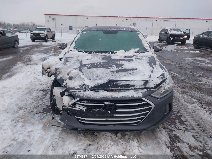 2017 Hyundai Elantra Se/Value/Limited VIN: KMHD84LF5HU425344 Lot: 12474597