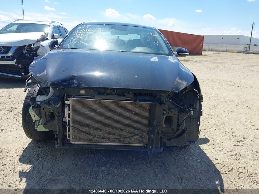 2020 KIA FORTE HATCHBACK 2.0L I-4 DOHC, VVT, 147HP