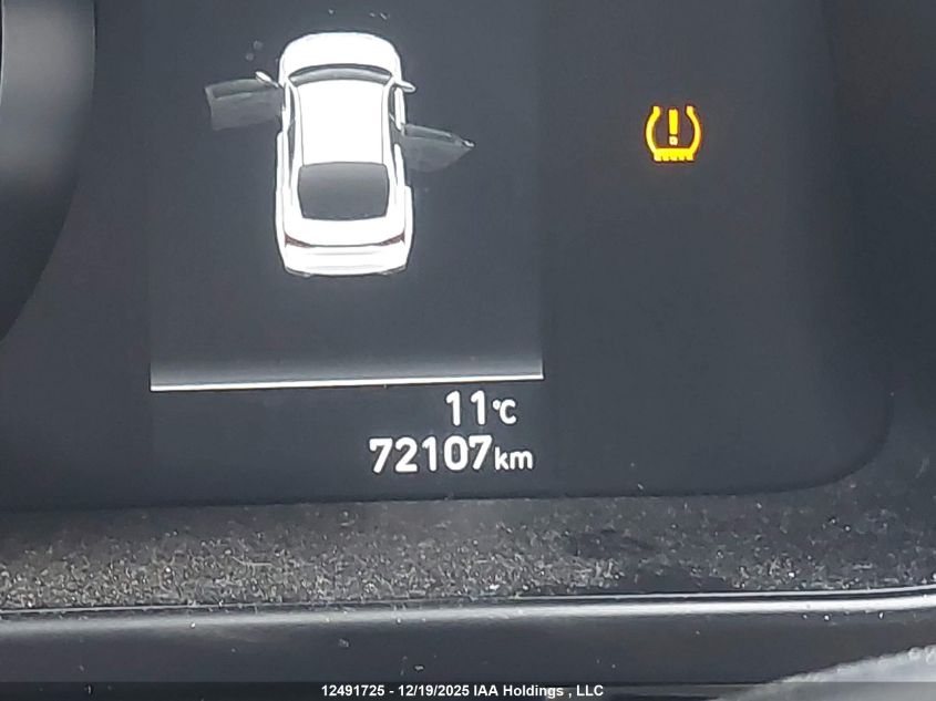 2021 Hyundai Elantra Preferred Ivt VIN: KMHLM4AG2MU100194 Lot: 12491725