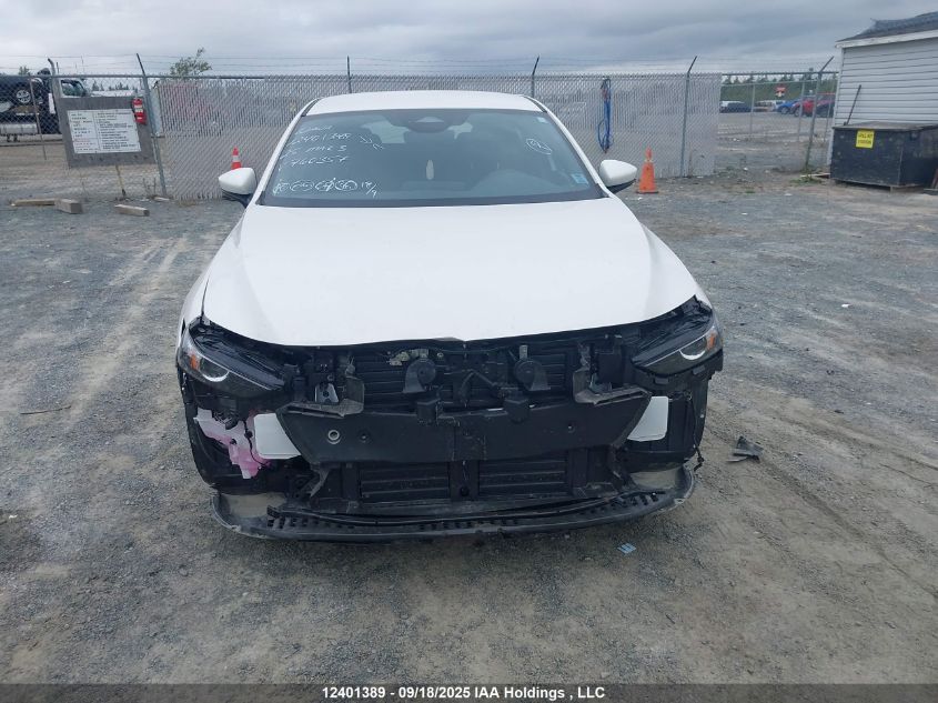 2025 Mazda Mazda3 Gx VIN: JM1BPAKM4S1760357 Lot: 12401389X