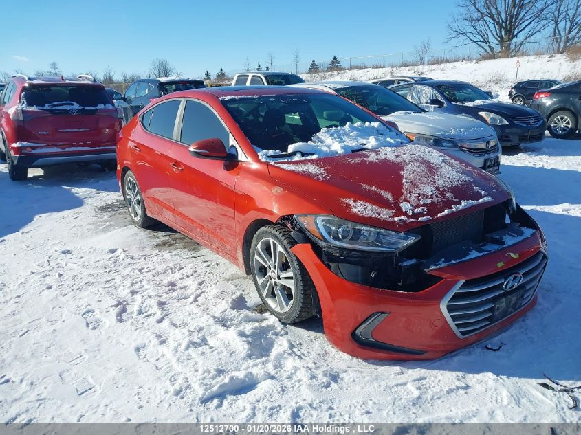 2017 Hyundai Elantra