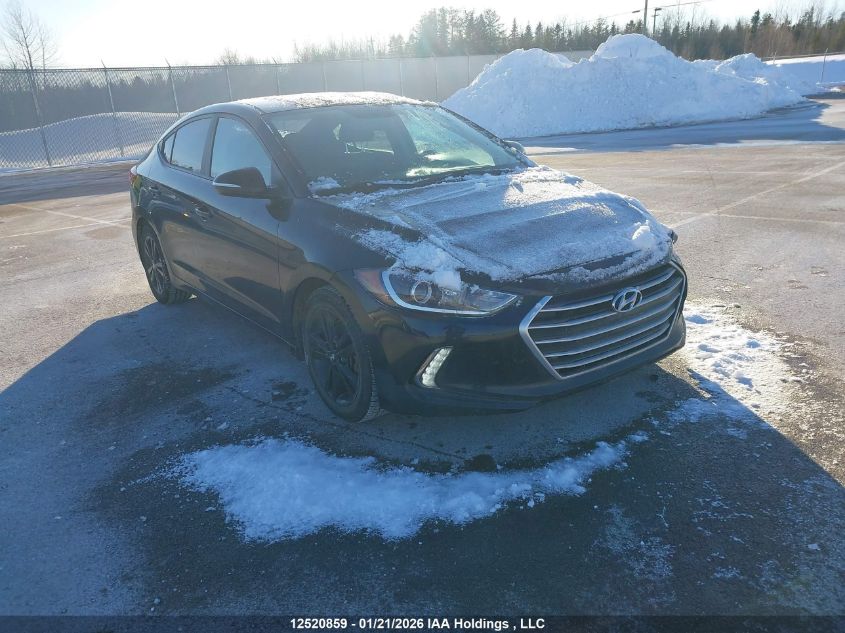 2017 Hyundai Elantra