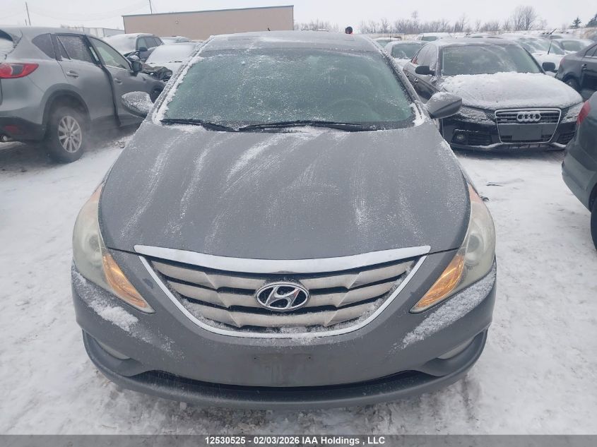 2013 Hyundai Sonata VIN: 5NPEB4AC4DH795174 Lot: 12530525