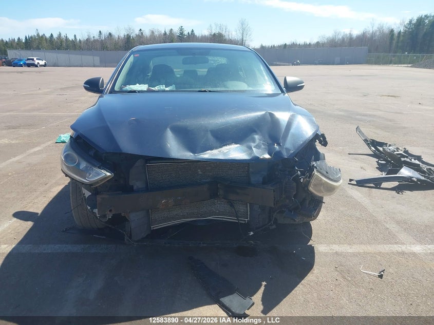 2017 Hyundai Elantra Se/Value/Limited VIN: KMHD84LF3HU182357 Lot: 12583890